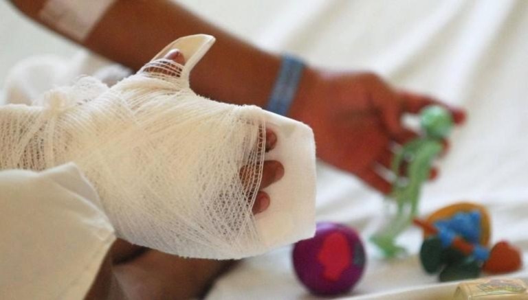 Brisa sufrió quemaduras en el 80 por ciento de su cuerpo (Especial)