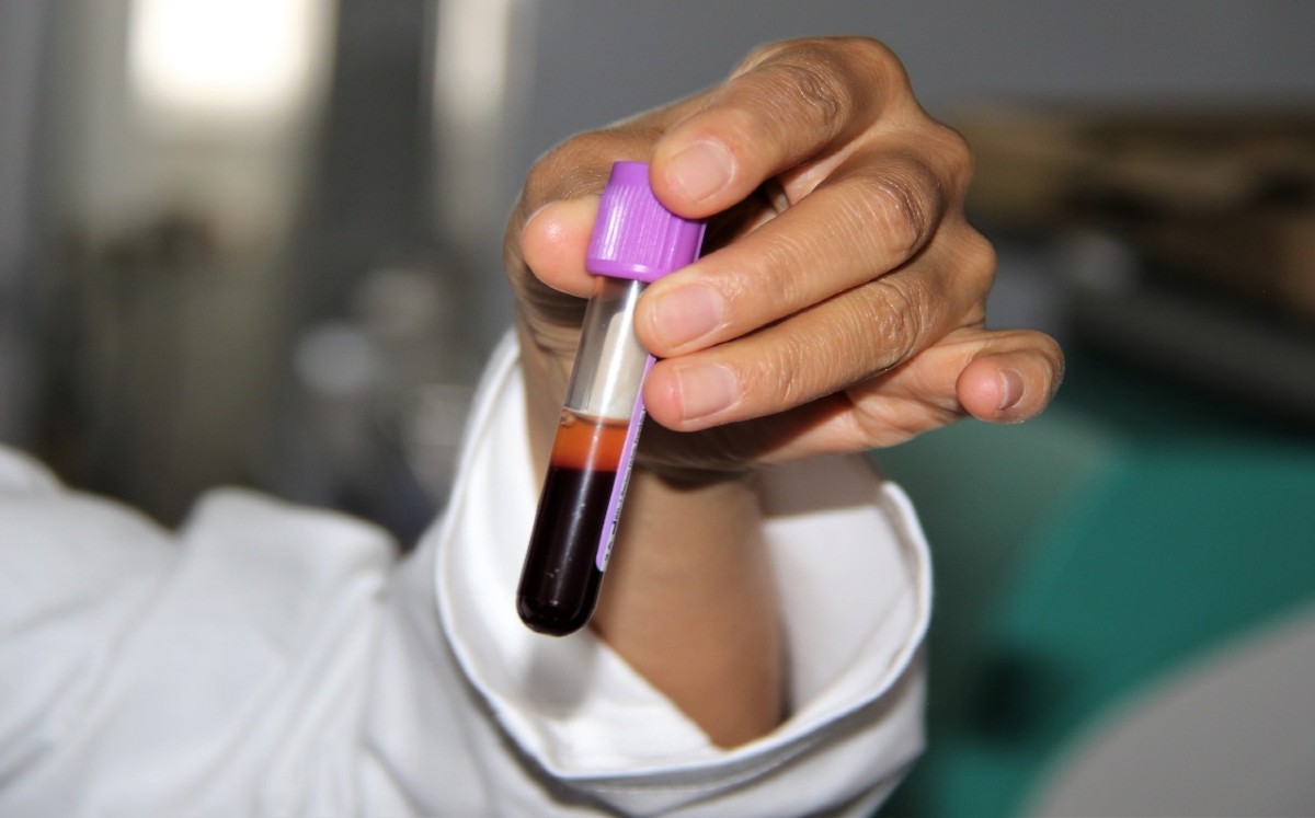 Estudios del IPN enfocado en la sangre de los pacientes para su estudio