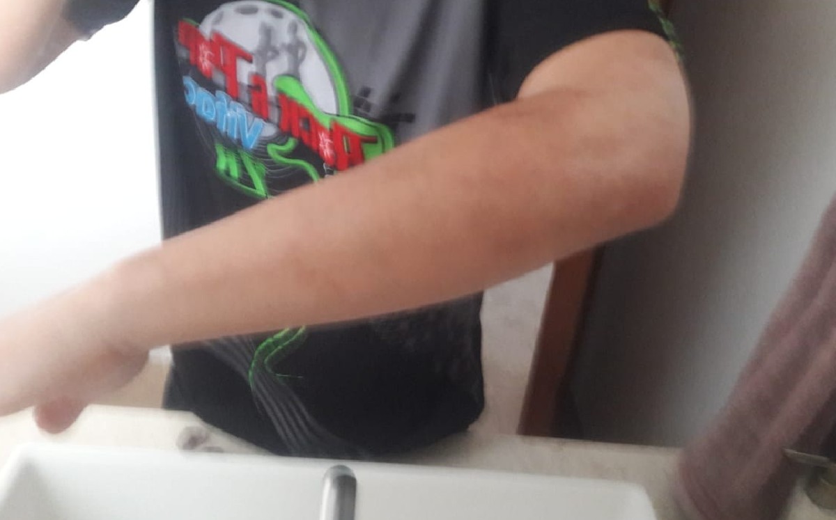 Agreden a joven por considerarse No Binario