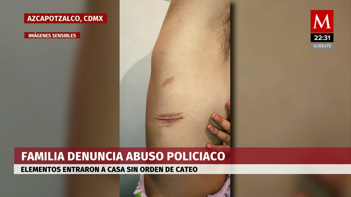 Adulta mayor es agredida durante operativo en Azcapotzalco