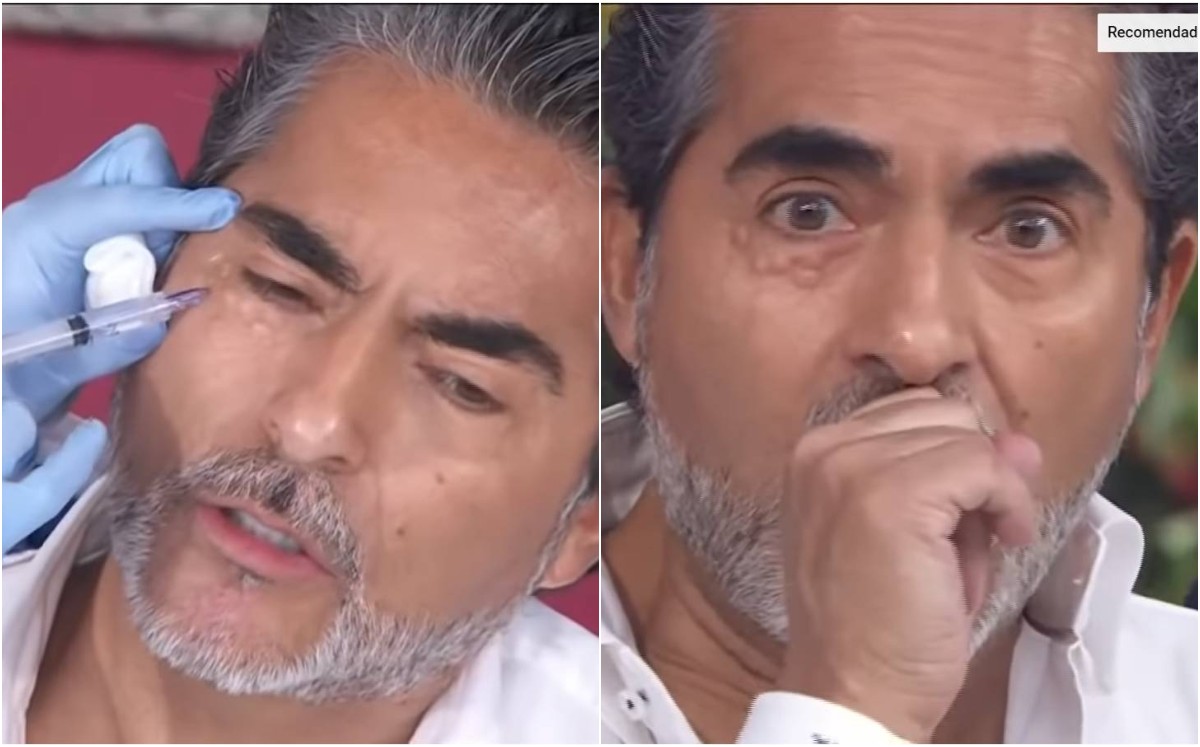 Raúl Araiza se somete a tratamiento de belleza en vivo; resultado causa preocupación (Captura).