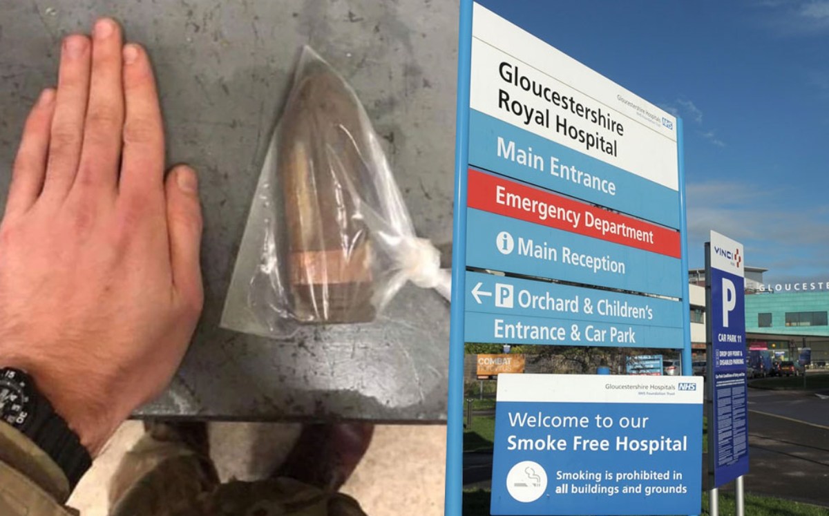 Extraen munición del recto de un hombre