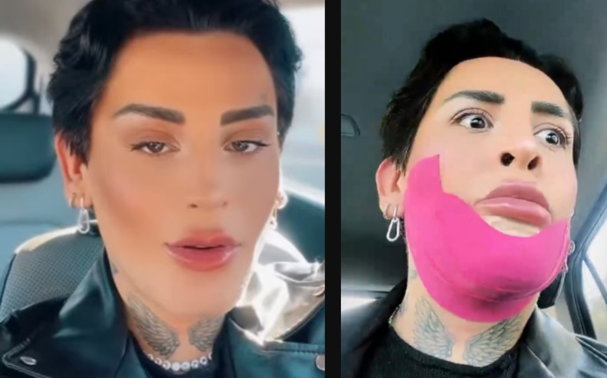 Kunno contra haters que lo criticaron por no poder sonreír |Especial