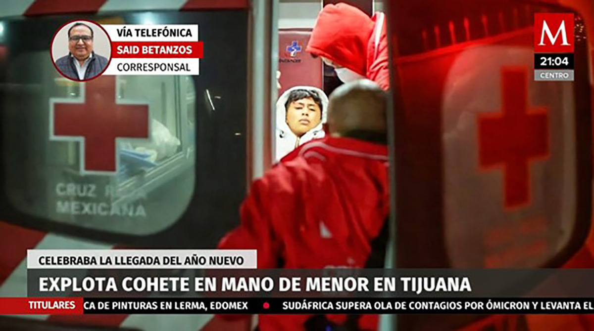 Explota cohete en mano de menor en Tijuana, celebraba el año nuevo