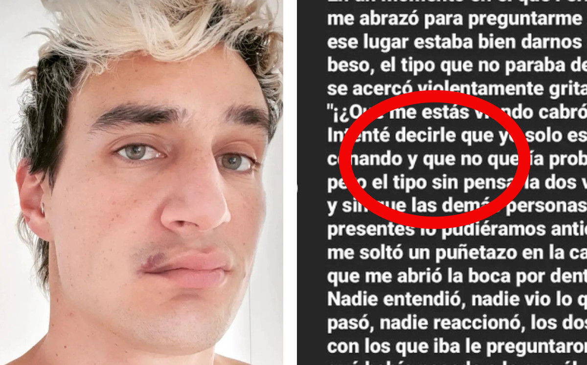 Pareja denuncia agresión homofóbica en taquería de CdMX. |Especial