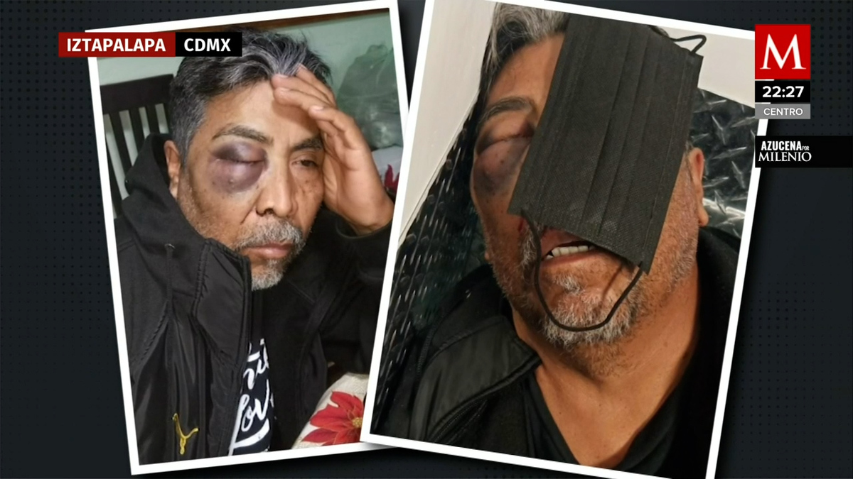 Rafael fue agredido por sus vecinos al denunciarlos