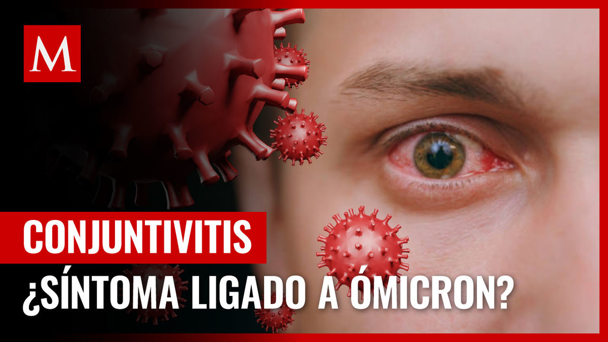 Conjuntivitis podría ser un nuevo síntoma de covid-19: estudio