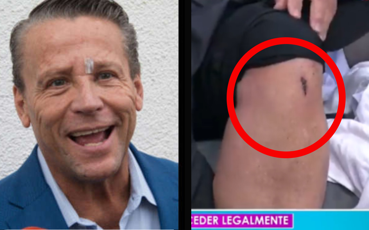 Alfredo Adame muestra las lesiones que le quedaron tras pelea callejera; demandará |Especial