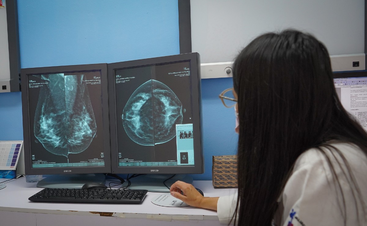 Mastógrafo en el Instituto Jalisciense de Cancerología (Cortesía)