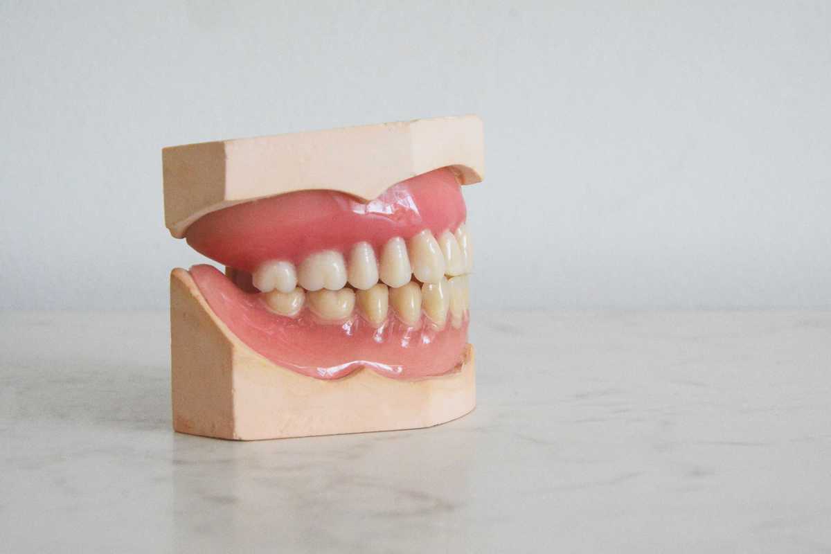 Dentadura (Pexels)