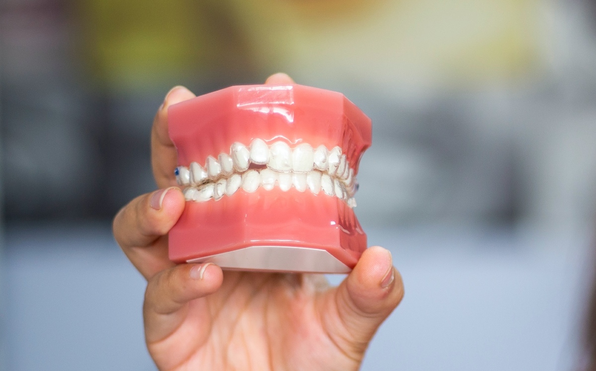 El hombre pudo recuperar la dentadura por su ADN (Pexels).