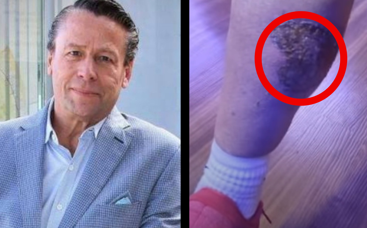 Alfredo Adame sufre accidente en moto con pipa |Especial