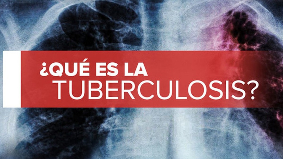 Día Mundial de la Tuberculosis: Qué es, síntomas, Tratamiento y cómo prevenirla