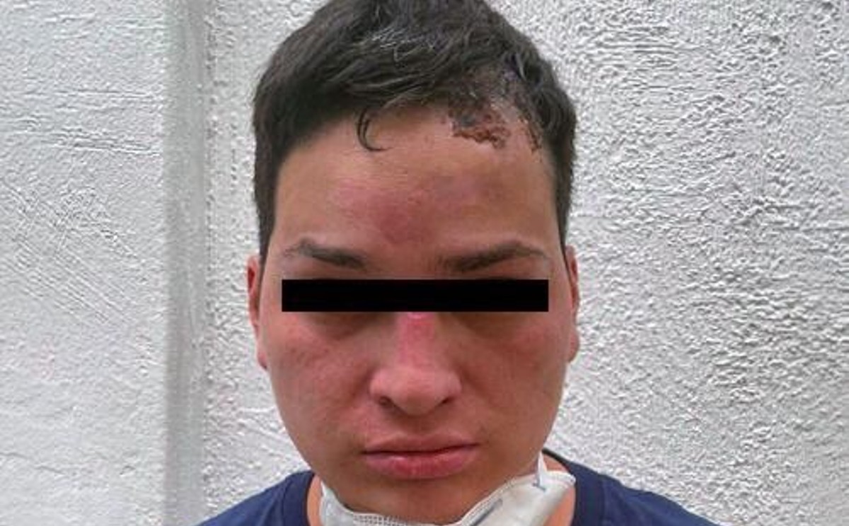 También está acusado de causar herir a dos pasajeros. (Especial)