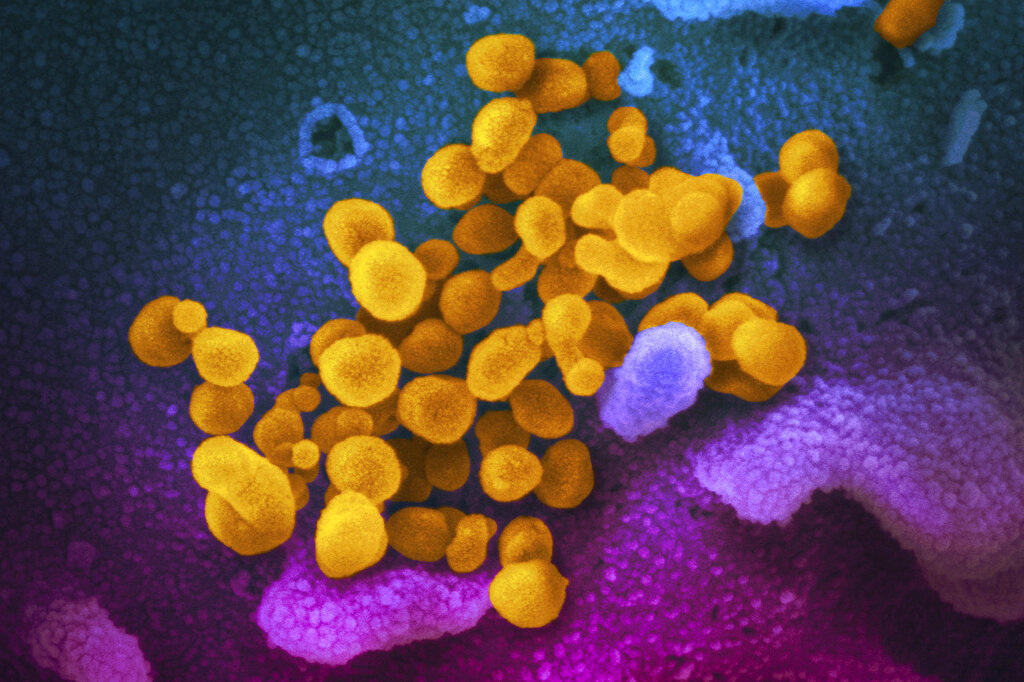 Podría ser la infección más larga. (AP)