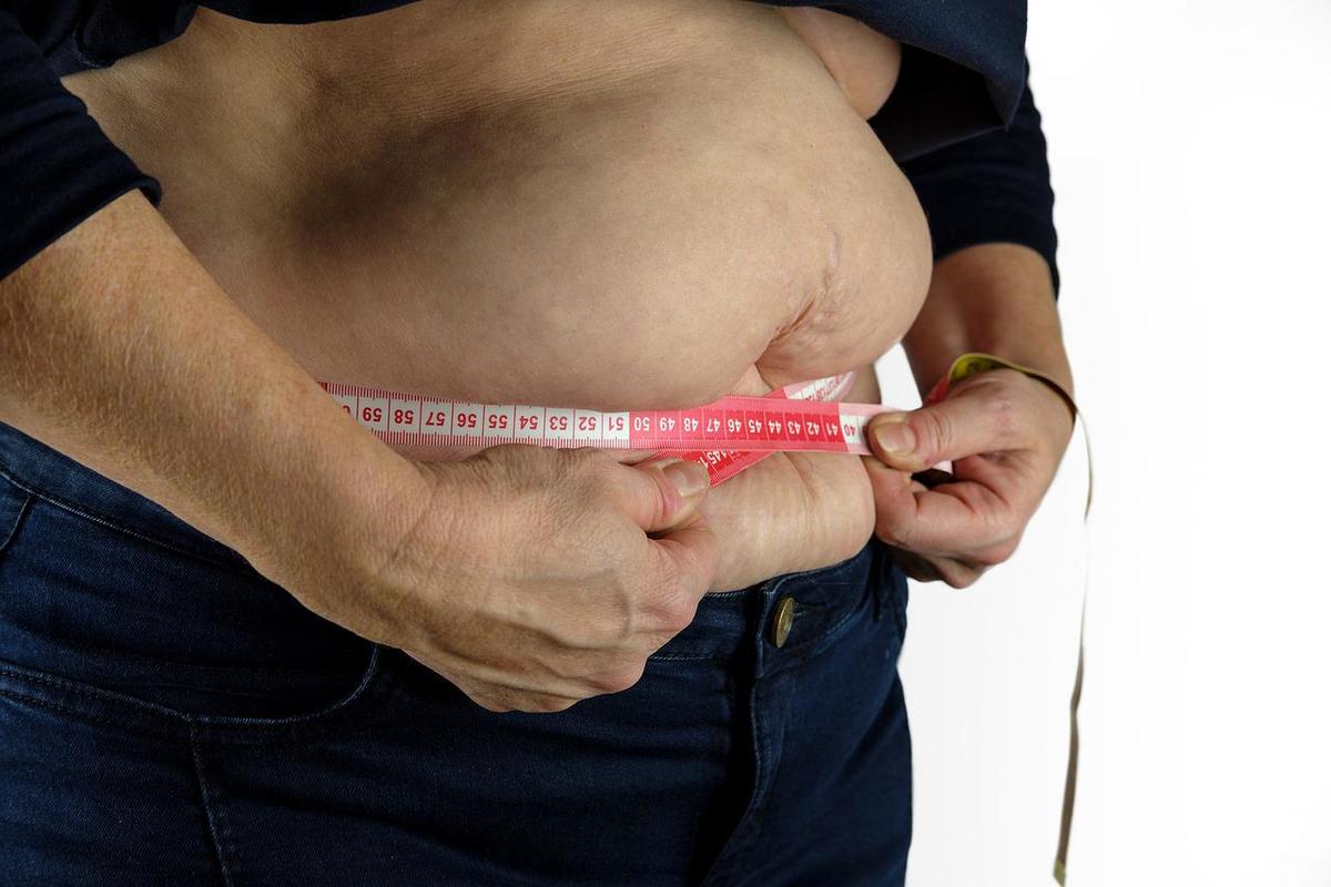 La obesidad y el sobrepeso aumentaron tras la pandemia del covid-19. | Foto: Archivo, Bru-nO en Pixabay