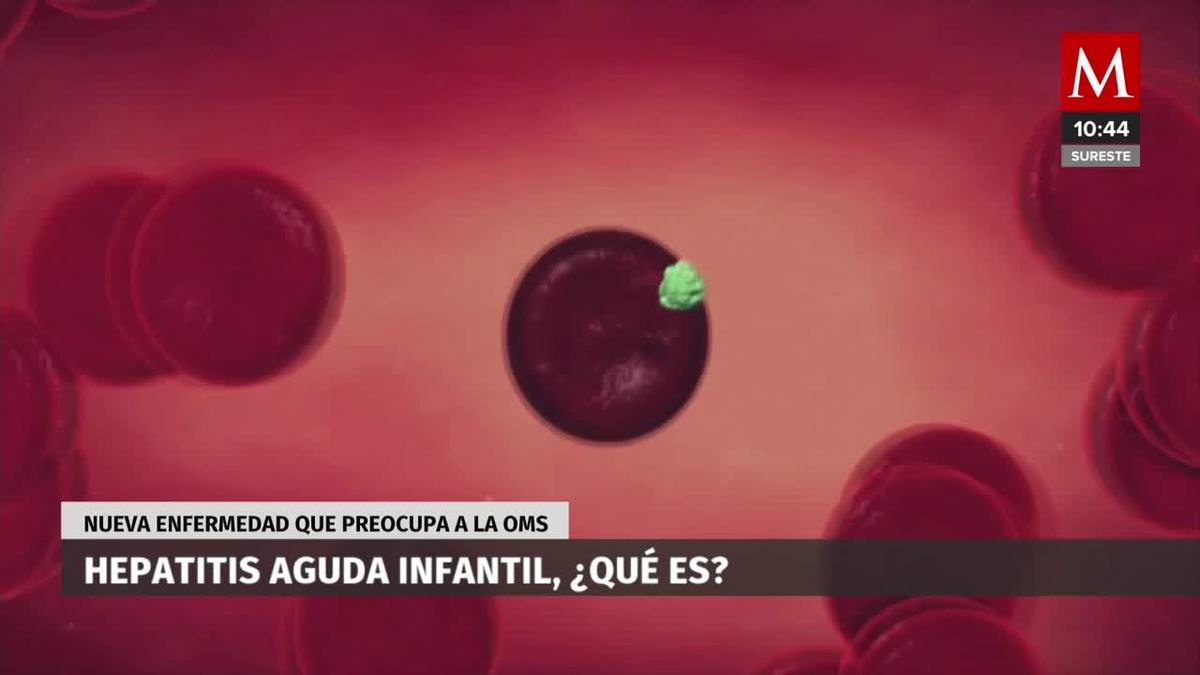 ¿Cuáles son los síntomas de la hepatitis infantil?