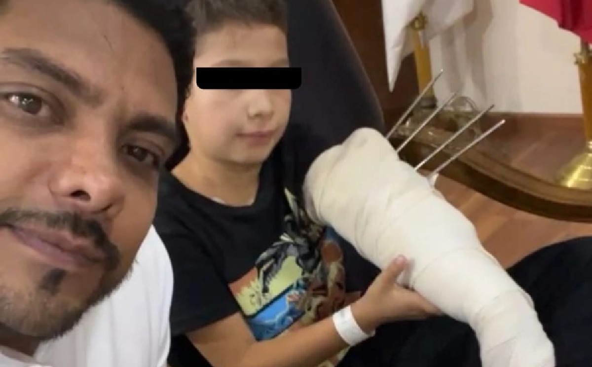 El menor acarició al lobo creyendo que era un perrito. (Especial)