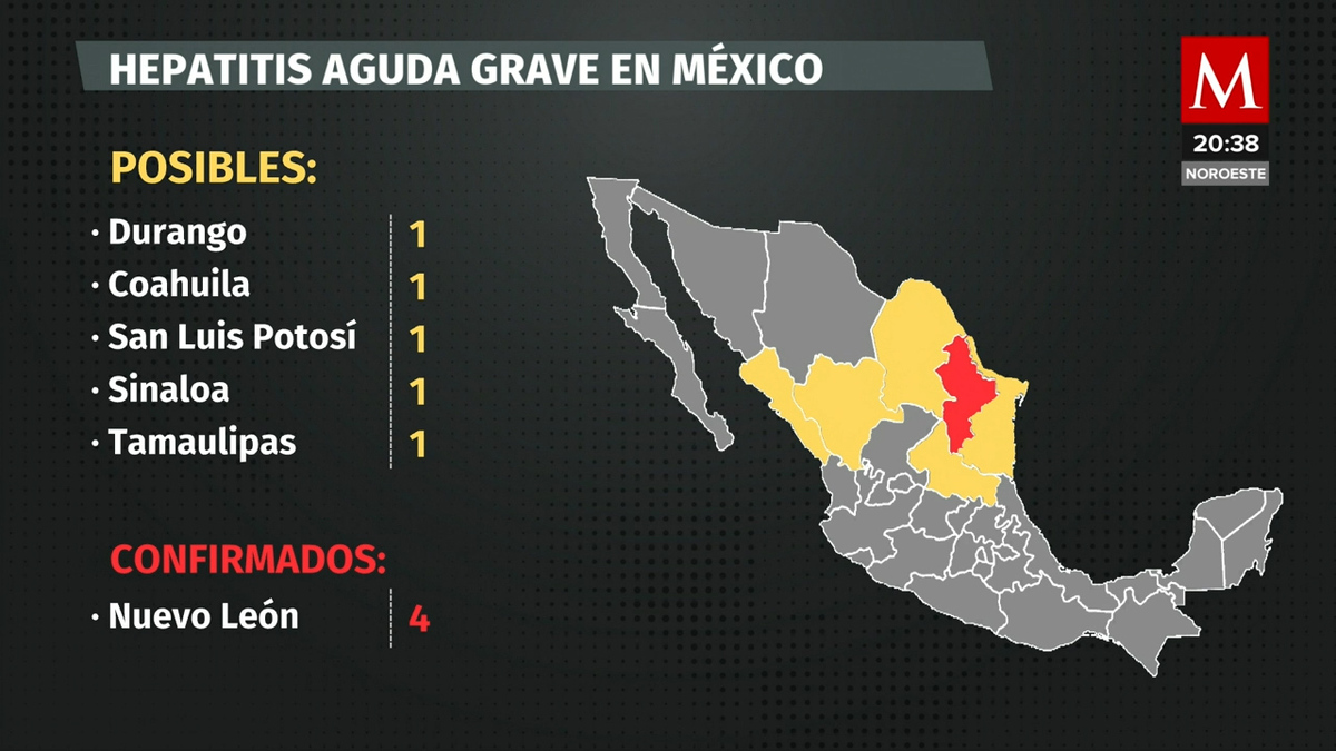 Reportan primer caso sospechoso de hepatitis infantil en Sinaloa