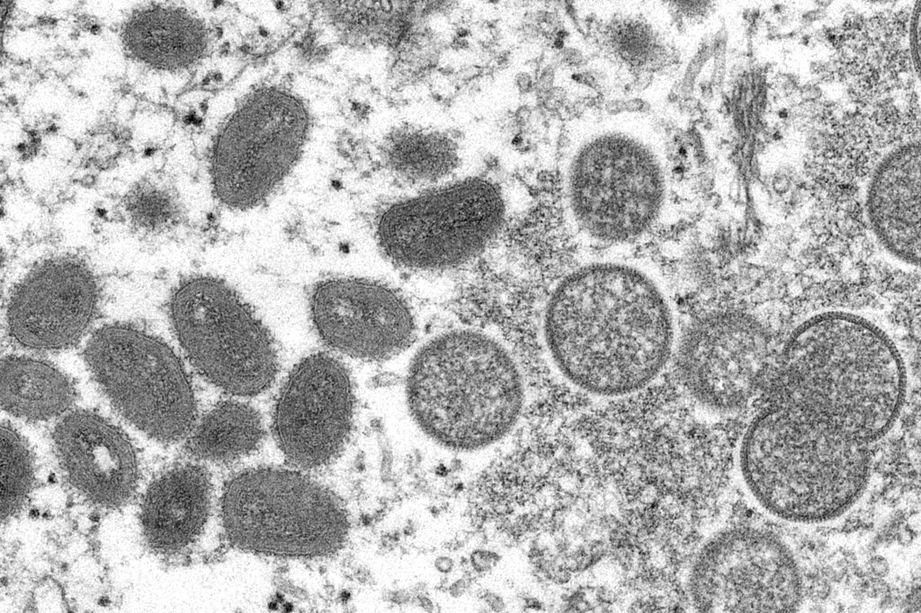 Imagen microscópica del virus del mono, analizado por los CDC de Estados Unidos. (AP)