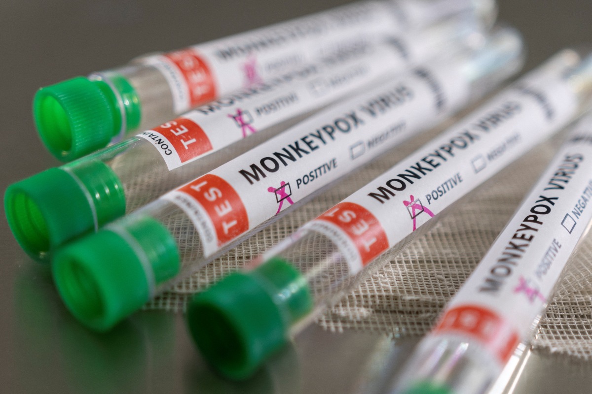 La viruela del mono se está propagando en el resto del mundo. (Reuters)