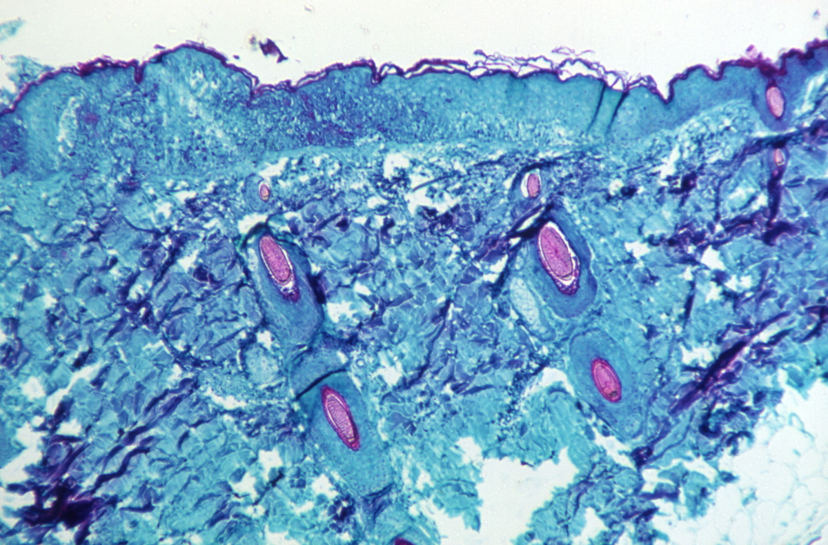 La imagen muestra un tejido infectado con la viruela del mono. | Reuters