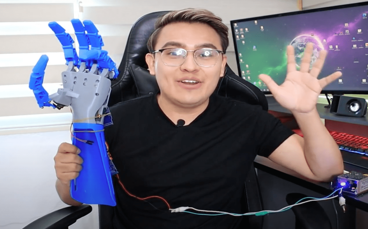 Joven crea inventos como prótesis humanas utilizando sus conocimientos de ingeniería. / Especial.
