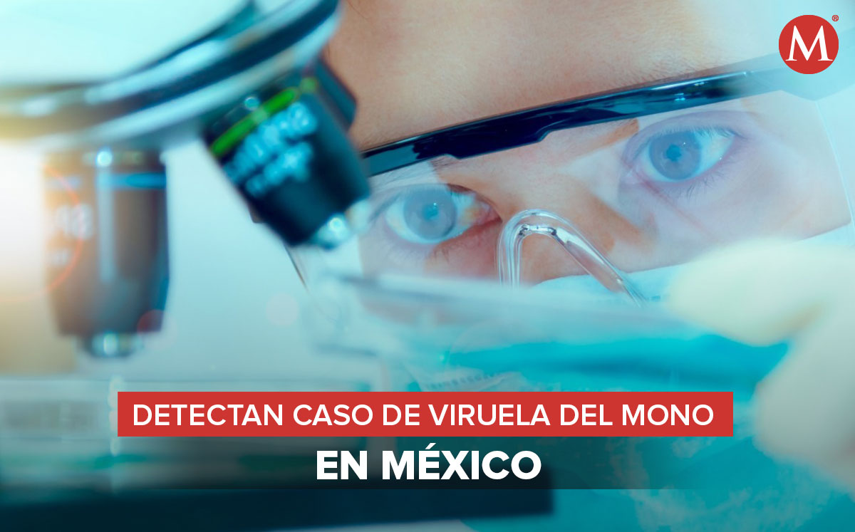 Primer caso de Viruela del Mono en México. (Especial)