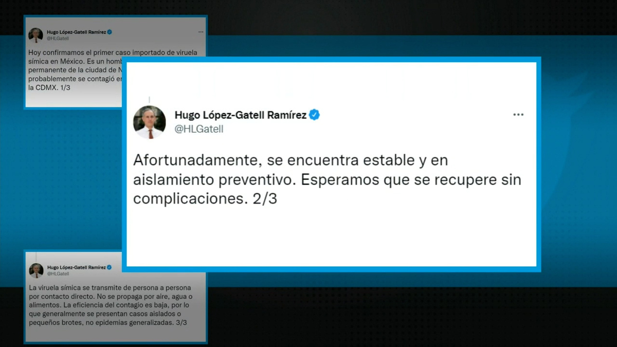 Hombre de 50 años y residente de NY: esto sabemos del primer caso de viruela del mono en México