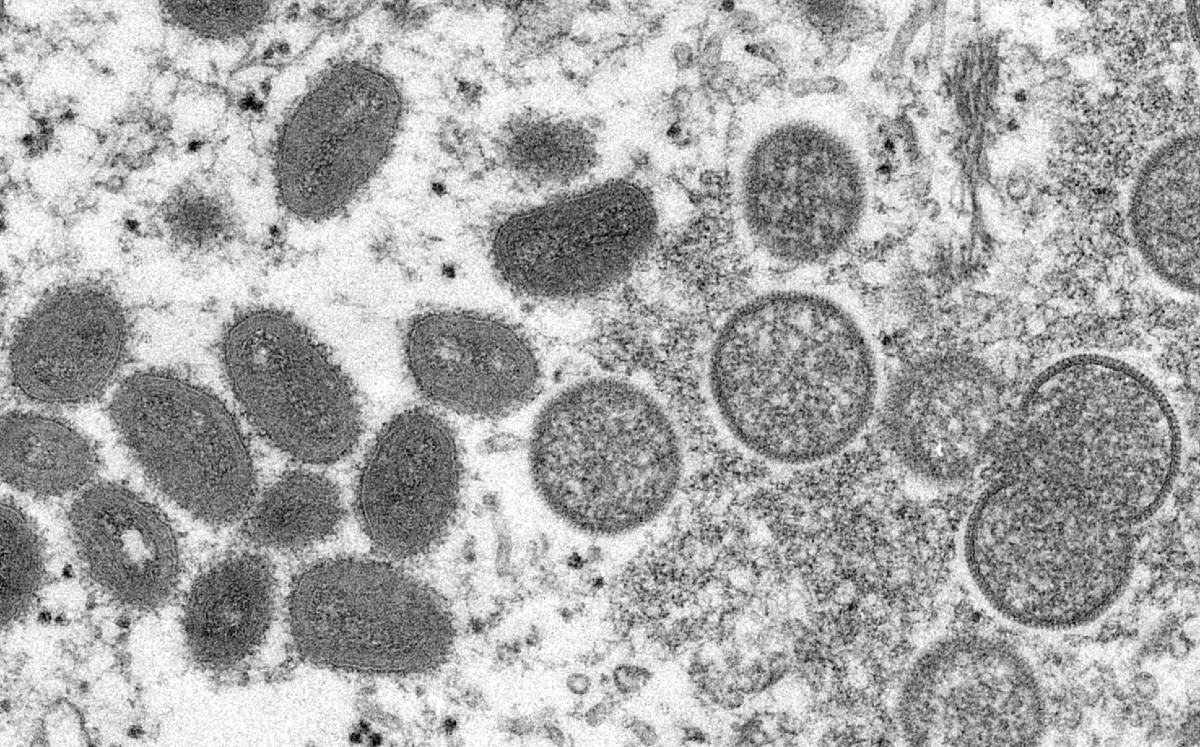 El virus de la viruela del mono vista desde un microscopio. | AP