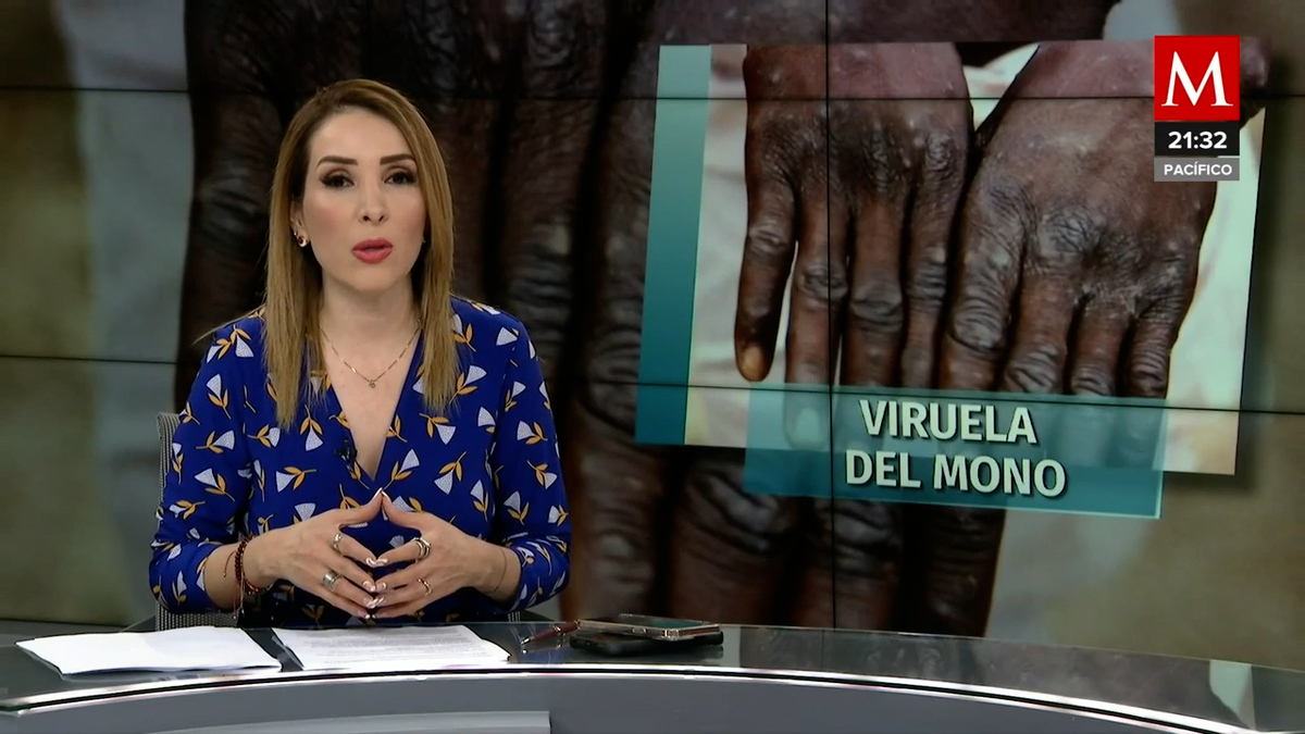 En Jalisco, se da el segundo caso de viruela del mono en México