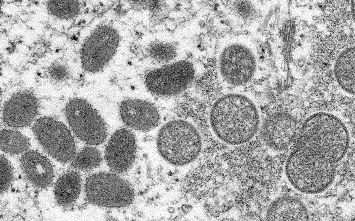 Viriones de la viruela símica tomados en 2003 con un microscopio. | AP