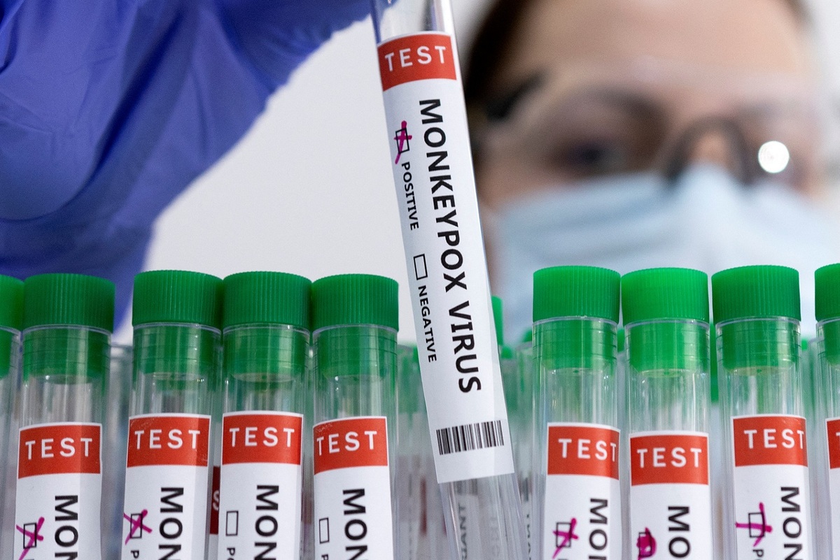 La viruela del mono se transmite mediante gotas de saliva u otras secreciones, indicaron los CDC. | Reuters