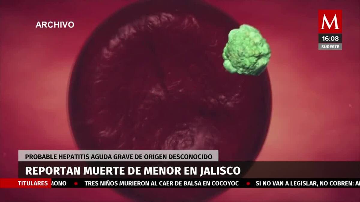 Muere niño por hepatitis aguda grave en Jalisco