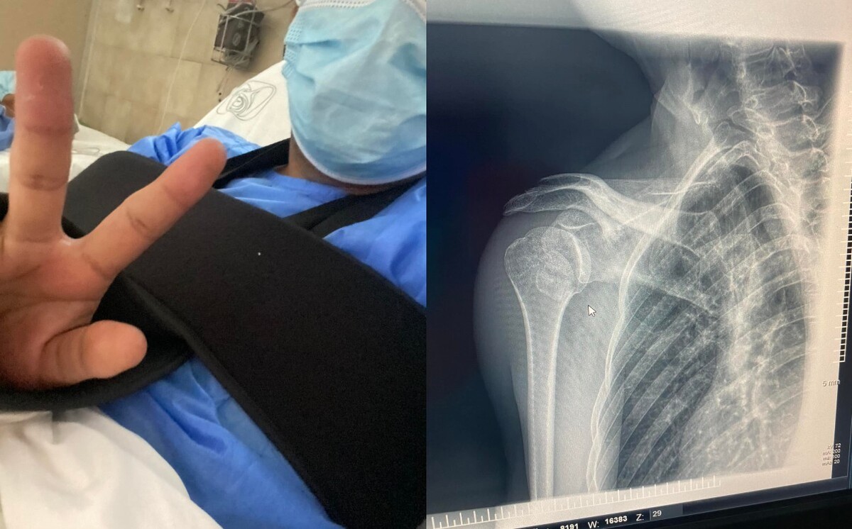 El joven lagunero pidió ayuda para salvar su brazo. (Especial)