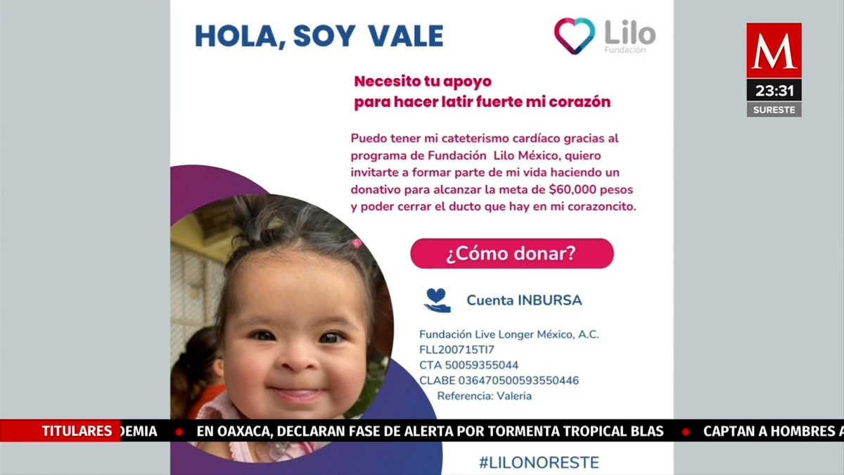 Valeria, pequeña con Síndrome de Down necesita una cirugía de corazón