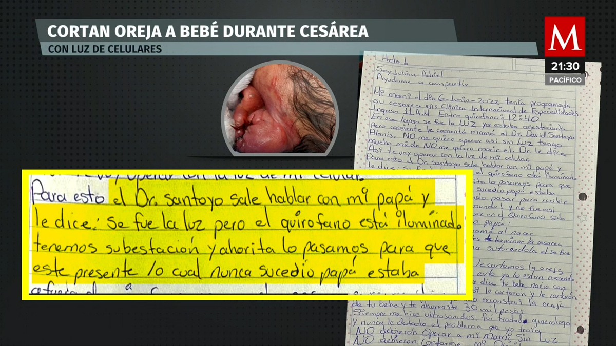 En BC, acusan que médicos cortaron oreja a recién nacido en cesárea