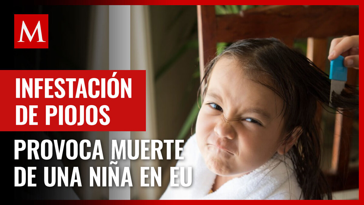 Niña de 9 años muere de anemia por masiva infestación de piojos en EU