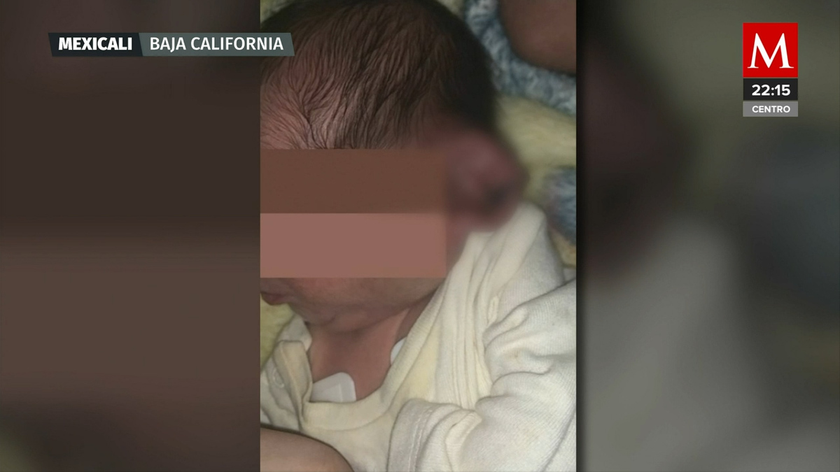 Declaran médicos por negligencia médica por cortar la oreja de un bebé en Mexicali