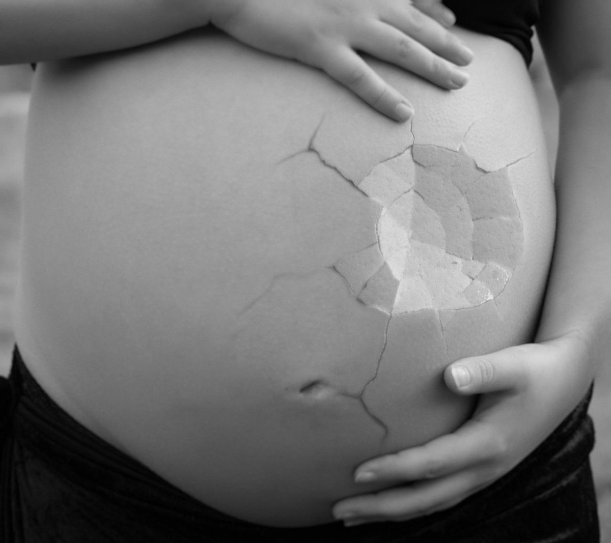Alemania suprime ley sobre el aborto | Pixabay