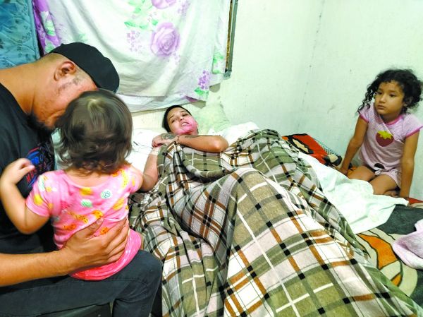 Elvia Liliana Torres tiene tres meses postrada en una cama recuperándose de las quemaduras que sufrió. Agustín Martínez