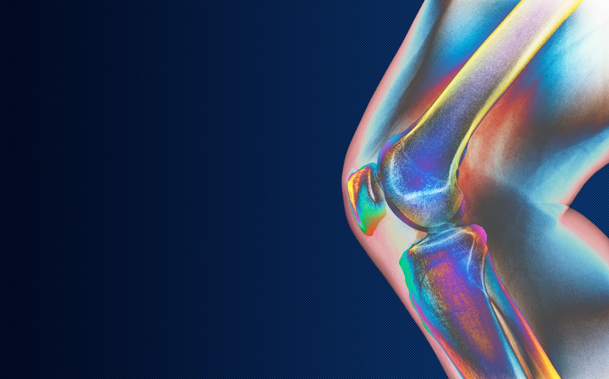 Cómo aliviar el dolor de las rodillas