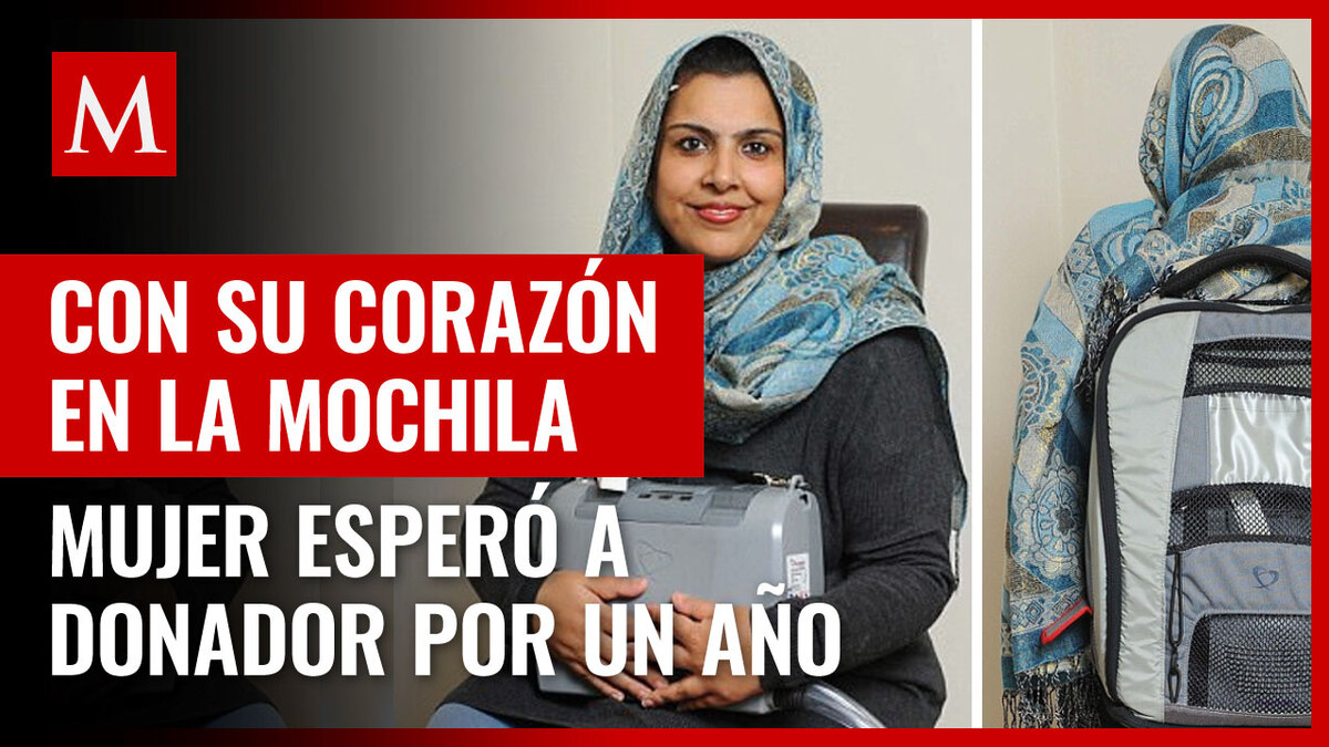 Reino Unido. Mujer vivió con su corazón en una mochila más de un año