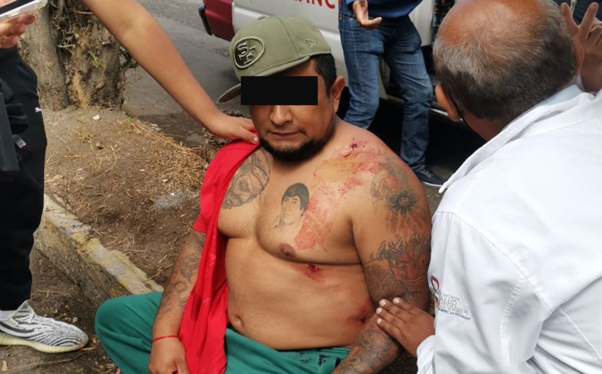 Fernando 'N' alias "La Zorra" fue herido en la balacera en un centro de vacunación en Puebla | Especial