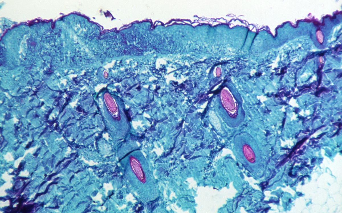 Una sección de tejido de piel, extraído de una lesión en la piel de un mono, que había sido infectada con el virus. | Reuters