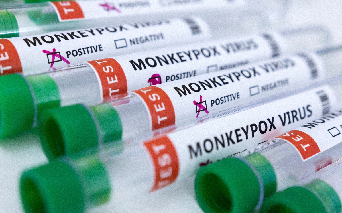 Estados Unidos es el país con más casos de viruela del mono en el continente. | Reuters