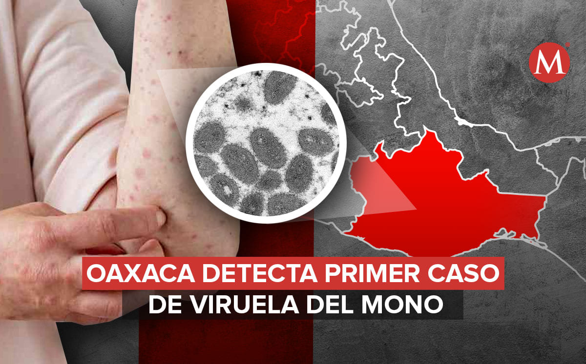 La Secretaría de Salud de Oaxaca dijo que el paciente se encuentra aislado | Diseño: Antonio Texta