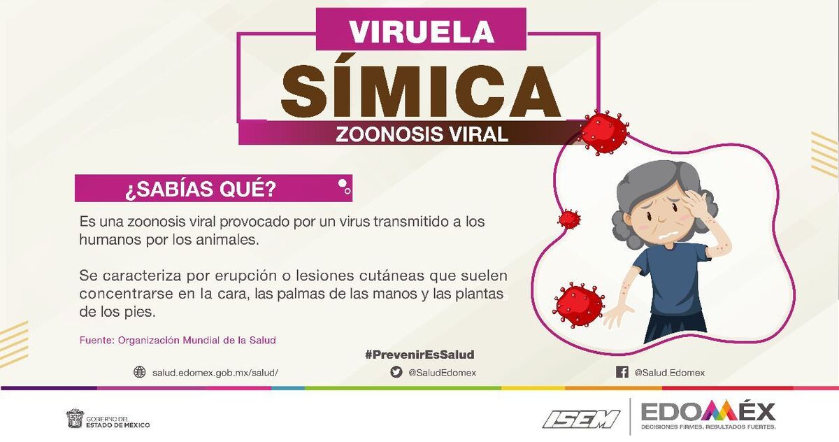 "ISEM: Viruela símica" | Especial.