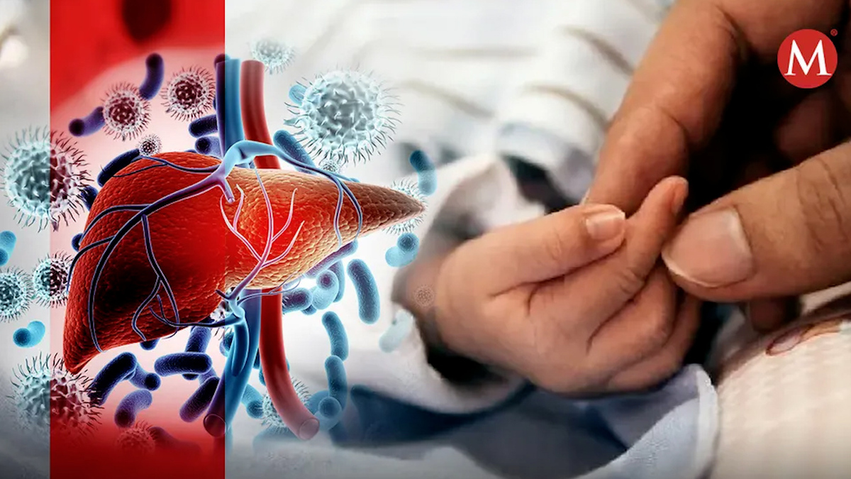 28 de julio se conmemora el Día Mundial contra la Hepatitis