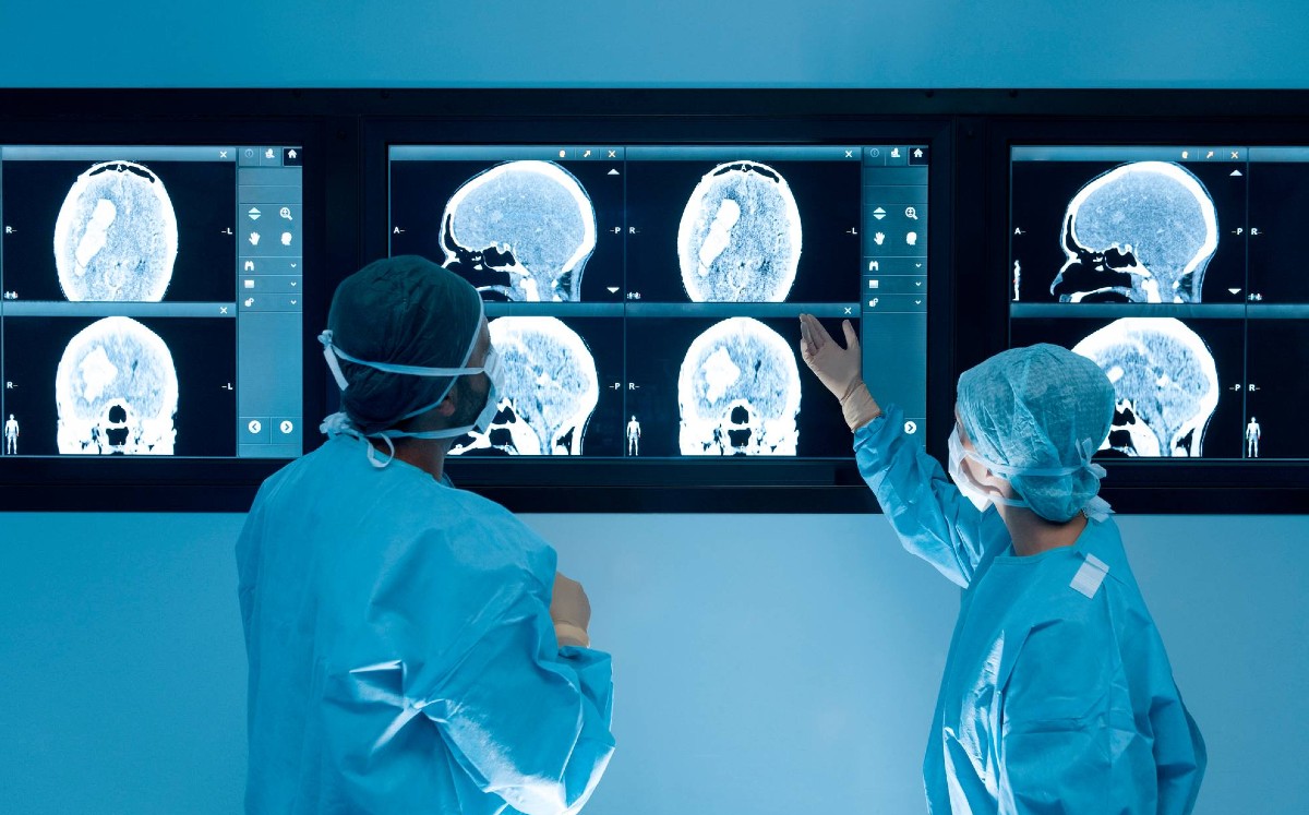 Derrames cerebrales y tratamientos para mejorar calidad de vida (Hospital Houston Methodist).